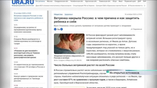 В СМИ и соцсетях активно обсуждают новую эпидемию ветряной оспы
