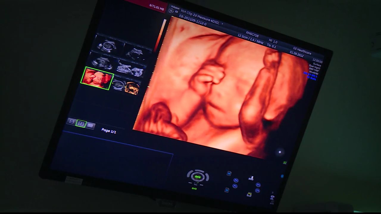 В Алтайском крае более 41 млн руб