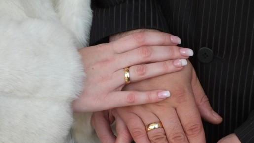 Руки станут белее снега: 3 правила ухода помогут убрать красноту