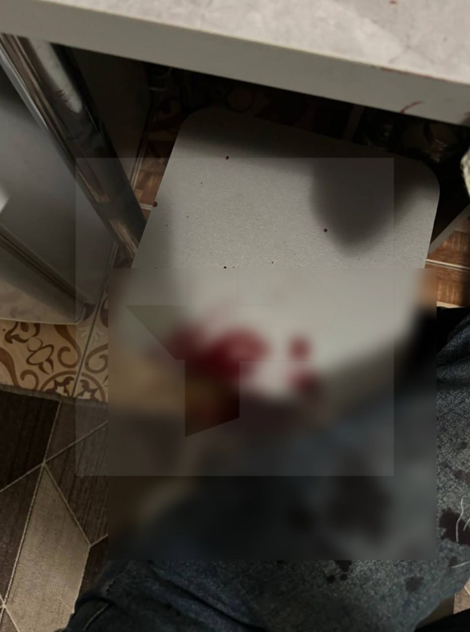 Пробил голову бутылкой: две девушки обвинили спортсмена в избиении в ночном клубе Бийска Пробил голову бутылкой: две девушки обвинили спортсмена в избиении в ночном клубе Бийска