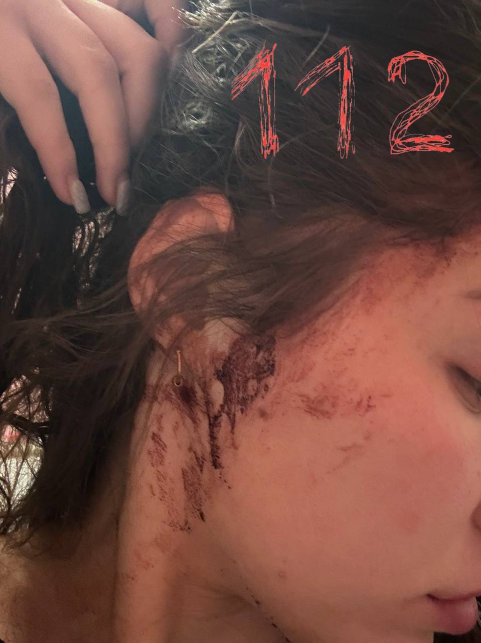 Двух девушек избили в ночном клубе Бийска Двух девушек избили в ночном клубе Бийска