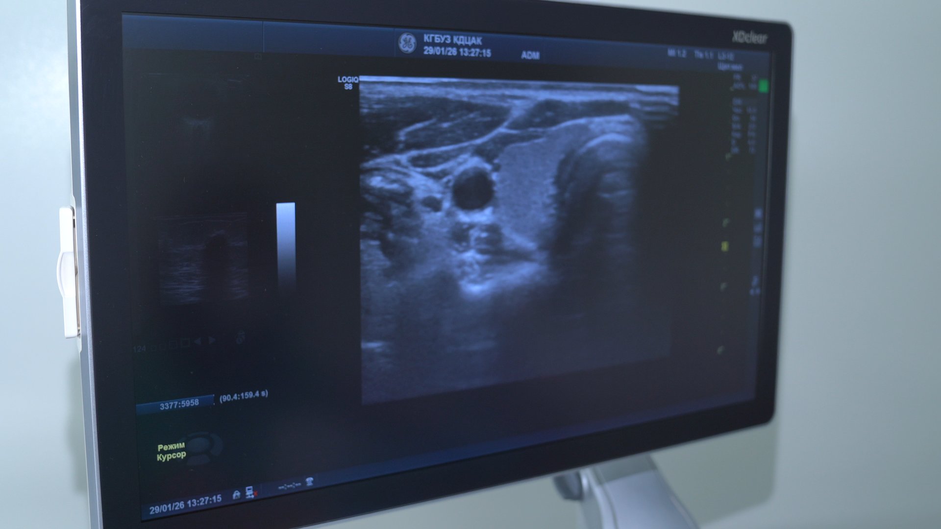 Система раннего выявления онкологии совершенствуется в Алтайском крае Система раннего выявления онкологии совершенствуется в Алтайском крае