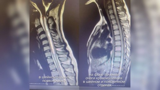 �������� �� ������ ��������: ������������ ����� ������ 18-������ ������� � ������ ���������� �������� �����