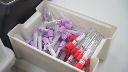 В Алтайском крае прошёл пик заболеваемости ВИЧ