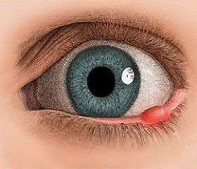 ������ �� �����: ��� ������ ����������� � ���������