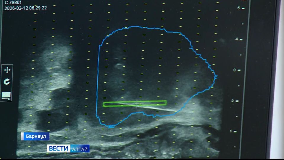 � ������� ����������� �������� ������� ����� ����������, ����������� ������� ��� �������� �� ������ ������