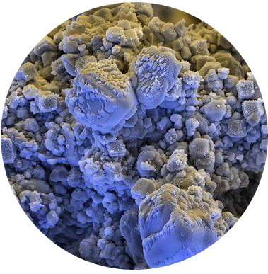 Накипь в чайнике: что с ней делать и как избежать проблем