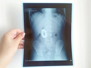 ������������� ������� �������� ������� ������ � ��������